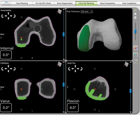 CT Scan