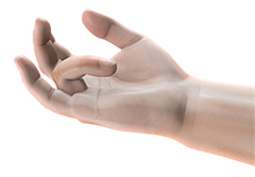 Dupuytren’s Contracture