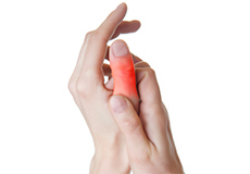 Finger and Thumb Sprain