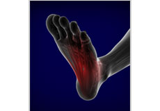 Foot Pain